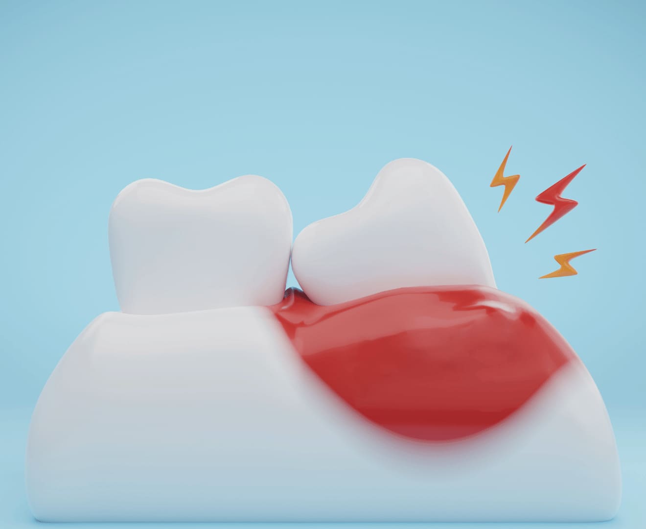 enfermedad periodontal