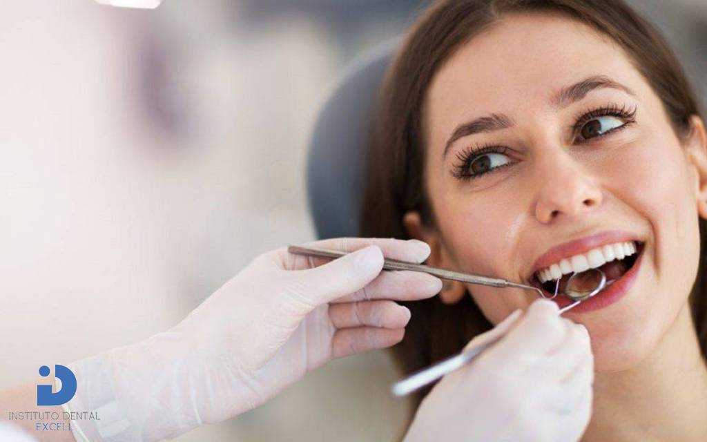 limpieza dental en Sevilla