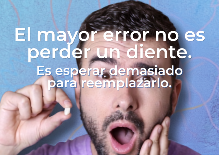 implantes dentales sevilla